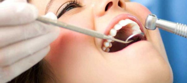 dental implant in paschim vihar